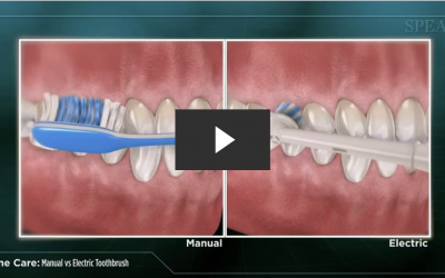 Manual Toothbrush versus Electric Toothbrush