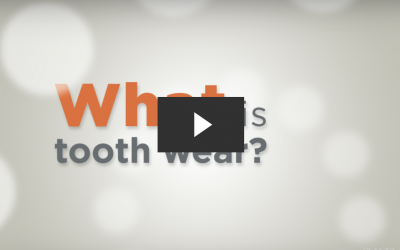 Understanding Tooth Wear