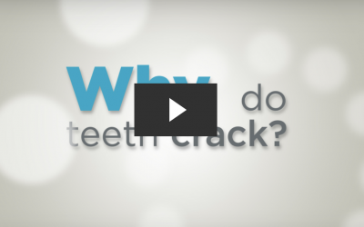 Why Do Teeth Crack?