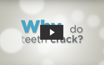 Why Do Teeth Crack? (No Instruments)